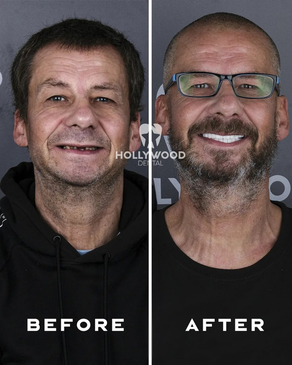 Slider image (2) Hollywood Dental Izmir Turkey